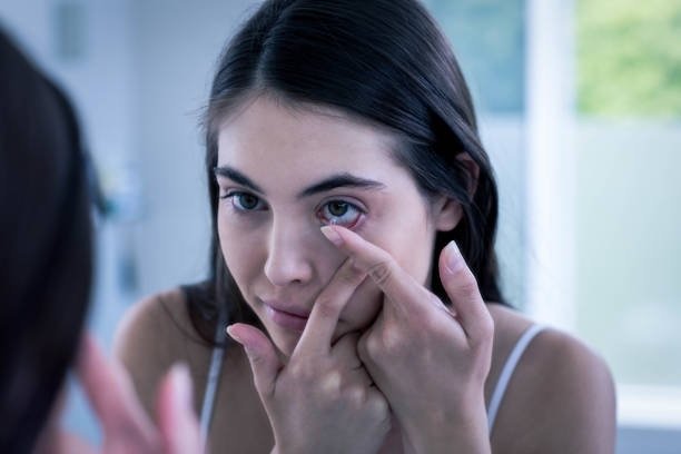 Exceptional Vision Care Services