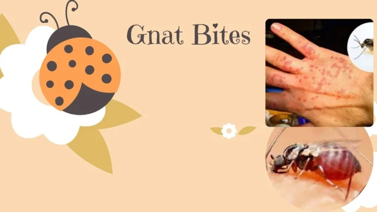 gnat bites